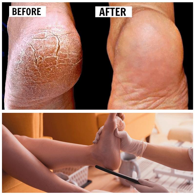 New Pedicure Foot File